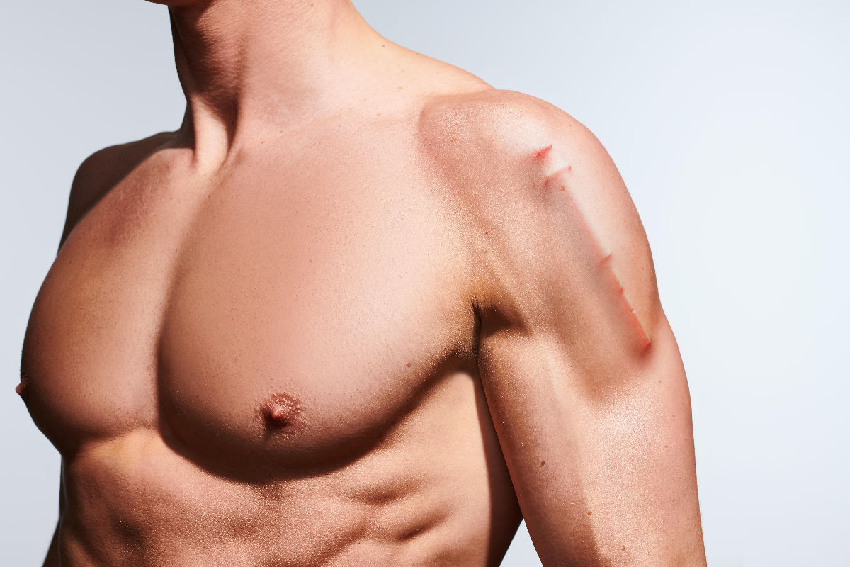 problemas por usar esteroides anabólicos