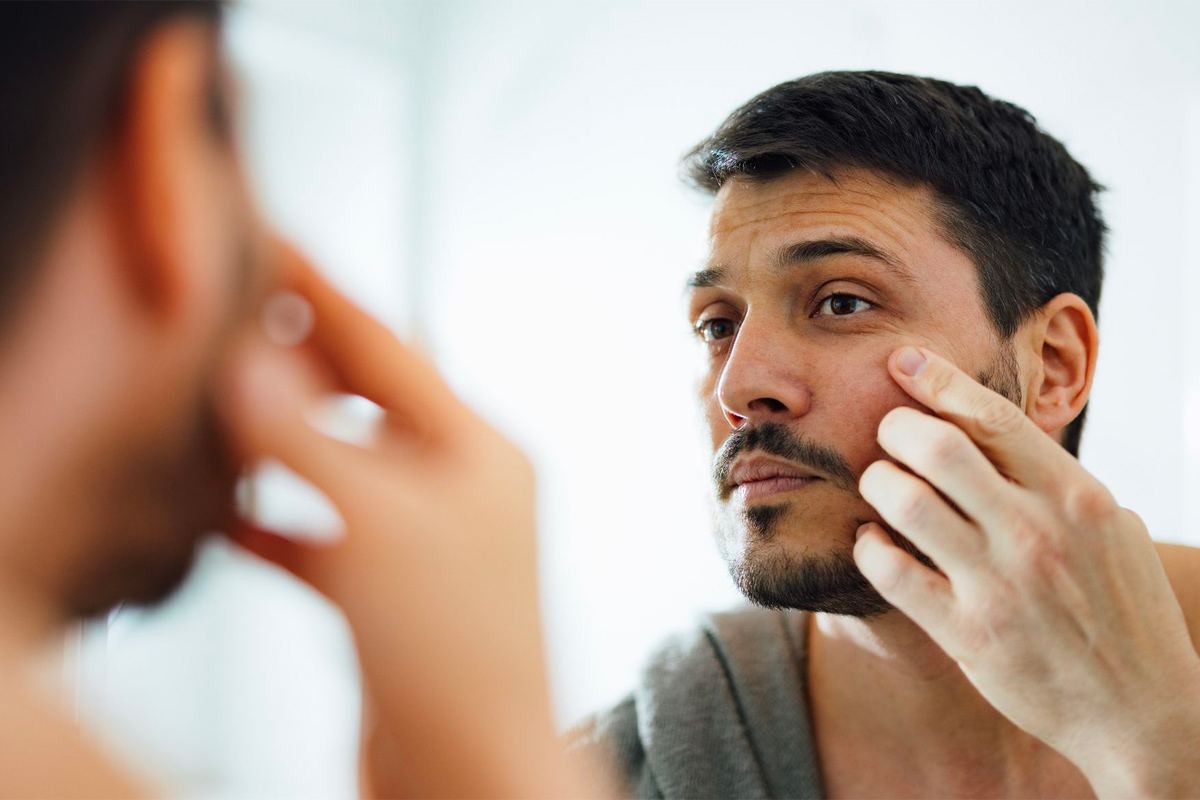 cómo eliminar los puntos negros