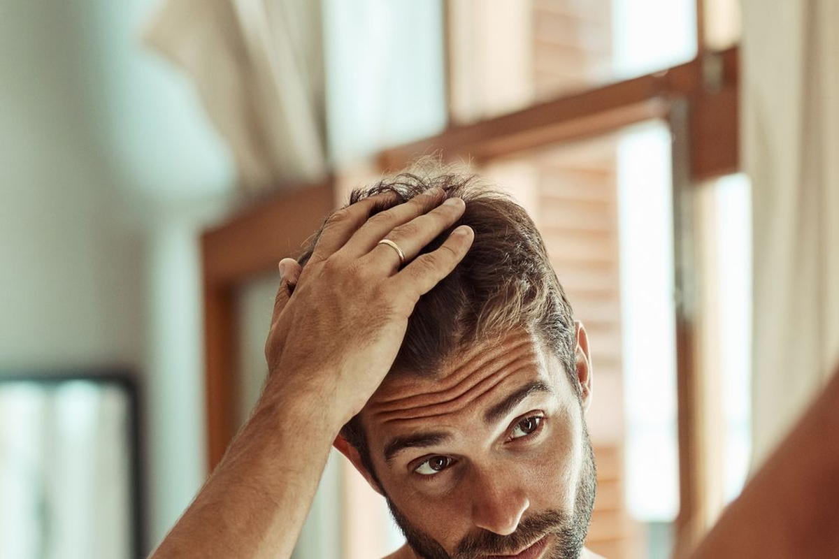 cómo combatir la calvicie