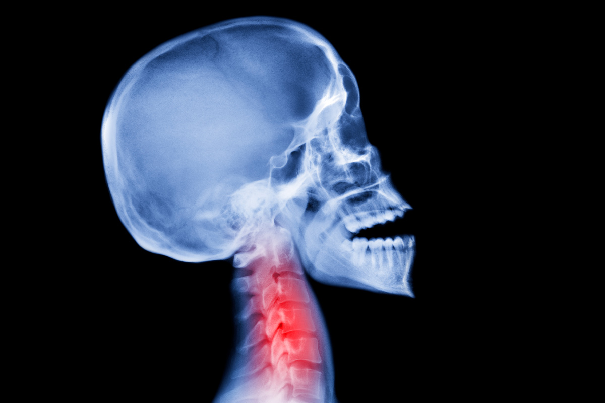 por qué deberías empezar a entrenar el cuello