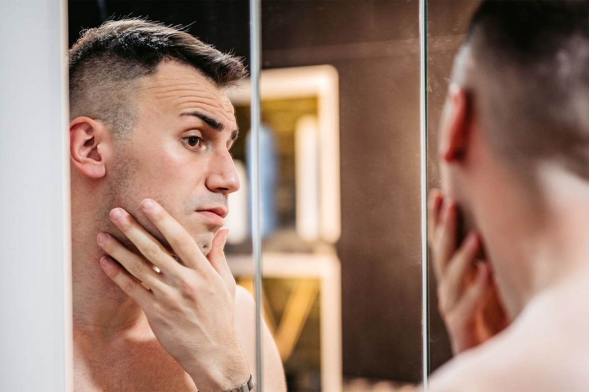 comer azúcar provoca acné