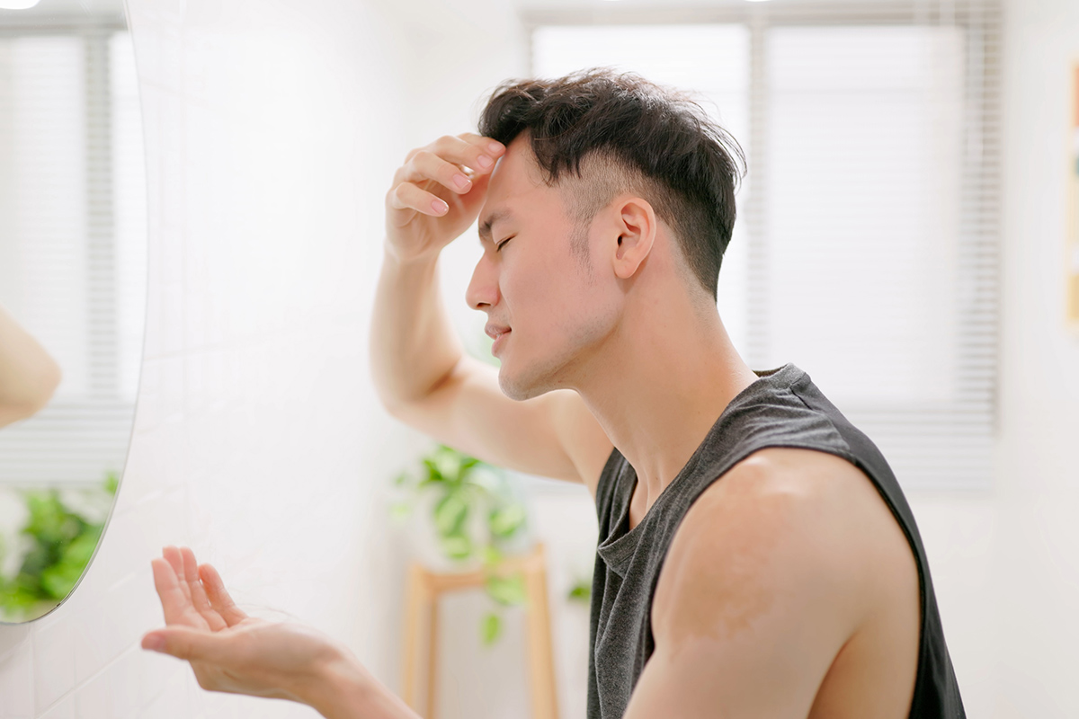 hombre tratando de disimular las entradas
